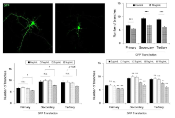 DKK2에 의한 신경세포의 수상돌기 퇴행과 분지 감소