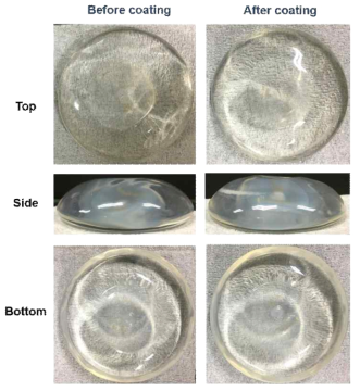 코팅 전후 보형물 사진