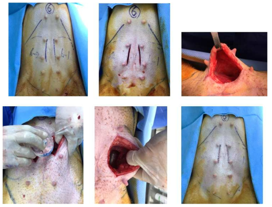 micro-pig에 유방 보형물 삽입 과정
