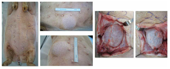 유방 보형물 삽입된 micro-pig로부터 조직 채취 과정