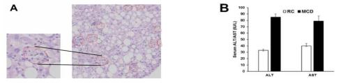(A) MCD를 8주 시행한 마우스 간조직에서 손상된 간세포 주변에 모여 있는 면역세포 (B) RD와 MCD를 8주 동안 먹인 후 채취한 혈액의 간수치 (ALT와 AST 변화)