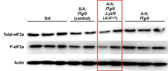 Western blot에 의한 여러 대조군과 A/ALyz 마우스로부터 순수 분리된 간 대식세포의 Total eIF2α와 P-eIF2α 발현수준 비교