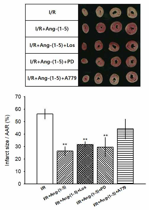 Ang-(1-5) 전처리가 허혈 후 재관류에 의한 조직의 infarct size에 미치는 영향