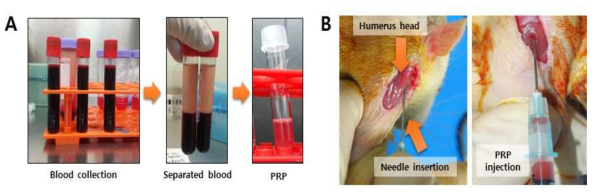 최적화된 혈소판 풍부 혈장 제작 및 랫트 모델에 주입