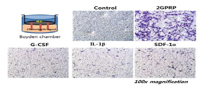 Boyden chamber assay를 이용한 혈소판 풍부 혈장 복합체의 랫트 골수 줄기세포에 대한 화학 주성 분석 (chemotaxis) 분석