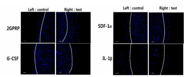 Under agarose chemotaxis assay를 이용한 혈소판 풍부 혈장 복합체의 랫트 골수 줄기세포에 대한 화학 주성 분석 (chemotaxis) 분석