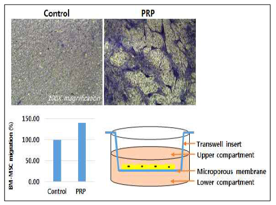 혈소판 풍부 혈장이 골수 줄기세포의 이동능에 미치는 영향