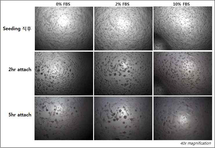 Under agarose chemotaxis assay에서 세포 분주시 FBS % 및 부착 시간