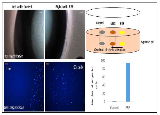 혈소판 풍부혈장 (Platelet Rich Plasma, RPP)이 줄기세포의 이동 능력에 미치는 영향