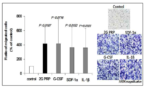 Boyden chamber assay를 이용한 혈소판 풍부 혈장 복합체의 골수 줄기세포에 대한 화학 주성 (chemotaxis) 분석