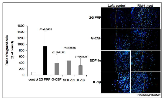 Under agarose chemotaxis assay를 이용한 혈소판 풍부 혈장 복합체의 골수 줄기세포에 대한 화학 주성 (chemotaxis) 분석