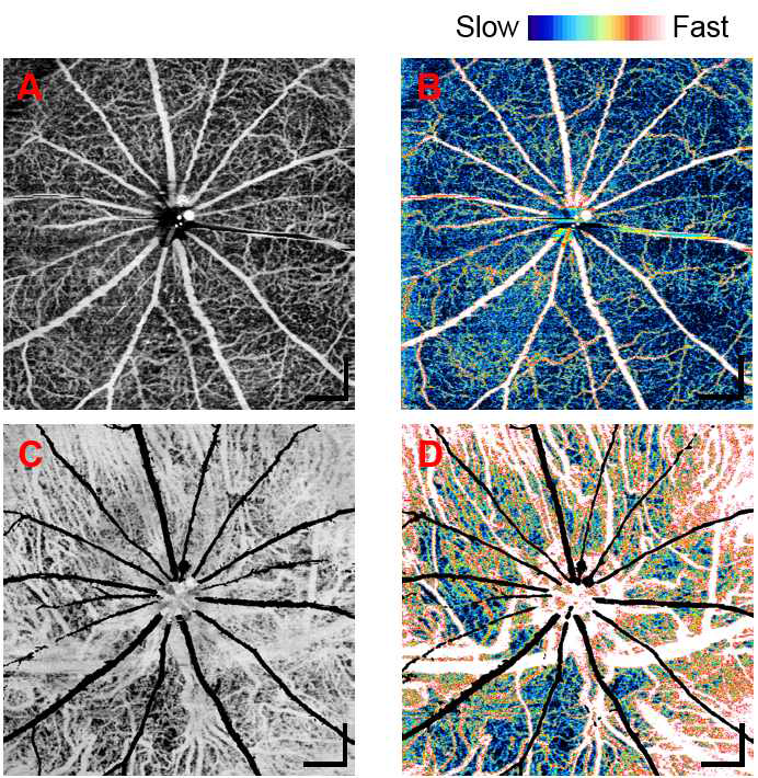 설치류 망막 및 맥락막 혈관조영 OCT로 이미징한 rat의 미세혈관구조 이미지. (A) 망막의 혈류속도 이미지. (B) 맥락막의 혈류속도 이미지. (black area는 망막층 두꺼운 혈관에 의한 shadow artifact.) FOV : 3.2mm x 3.2mmm