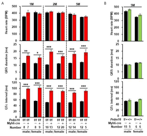 마우스에서 심전도 측정 (A) 1개월, 2개월, 5개월 실험군 (Prdm16flox/flox; Myh6-cre), 대조군 (Prdm16flox/flox; no cre), (B) 5개월 두 종류의 대조군 마우스들 (Prdm16flox/+; no cre  Myh6-cre) (*, P<0.05; **, P<0.01; ***, P<0.005)
