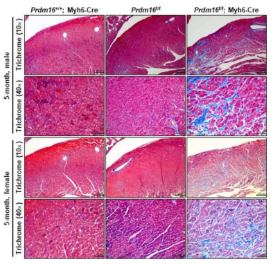 5개월 실험군과 대조군들 마우스 심장 조직 paraffin 절편을 Trichrome 염색법을 이용하여 염색 후 조직 섬유화 관찰