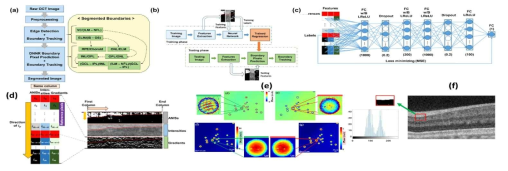 (a) 다중 분할 단층 이미지 기반 segmentation 분석 절차 흐름도, (b) 각각의 단계에서 수행되는 DNN의 절차 및 이를 이용한 뇌 신경 다발 분석 방법, (c) DNN의 세부적인 논리 구조 및 이를 기반으로 하는 논리 결과 도출 흐름도, (d) DNN의 실제 응용에 의한 이미지 분석 모식도, (e) Fourier transform of the recorded interferogram 을 이용한 맵핑 결과, (f) Otsu clustering window 와 샘플링에 따른 실제 histogram IEEE Transactions on Image Processing 29, 303 (2020), 국제 전문 학술지 게재