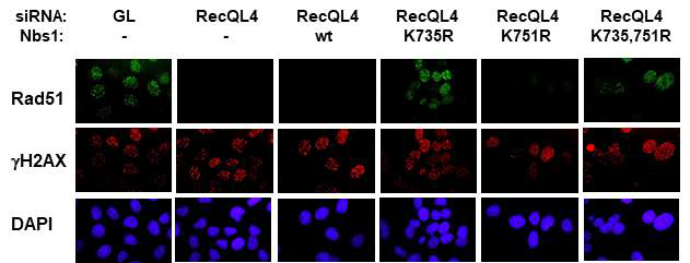 유비퀴틴화가 일어나지 않는 Nbs1 돌연변이가 RecQL4 결핍세포에서 HR 수선 능력에 미치는 영향. siRNA로 RecQL4의 발현을 억제하고, 각각의 야생형 또는 돌연변이 Nbs1 단백질을 발현 시킨 다음, NCS 처리 1시간 후에 Rad51 foci를 관찰한 결과. K735R 돌연변이 Nbs1 단백질이 발현된 경우에만 Rad51 foci가 관찰되었음. 이는 Nbs1의 유비퀴틴화가 일어나지 않아 안정성이 증가하면 RecQL4 결핍 세포에서도 HR 수선 능력이 회복됨을 의미함