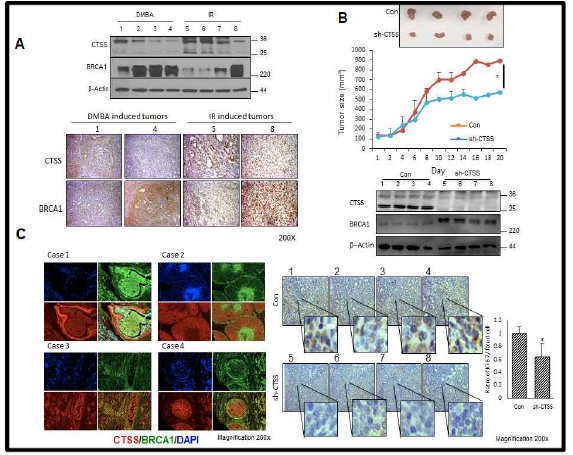 Delayed tumor growth by inhibition of CTSS with recovery of BRCA1 expression (A) WB and IHC for BRCA1 and CTSS was performed using rat mammary tumor tissues. (B) Changes in the tumor volume in xenografted SCID mice (n = 4/group) with sh-Control or sh-CTSS stably expressed MDA-MB231 cells (1 × 107). Tumor size was measured twice weekly. (*p<0.05) (upper). WB of CTSS and BRCA1 expression in tumors (middle). Representative IHC of Ki67 and quantification of Ki67 positive cells was performed (bottom). *p<0.05 vs. sh-control cells xenografted mice (C) IHC for BRCA1 and CTSS using human mammary cancer tissue microarray (n=70), was performed (CTSS: red; BRCA1: green)