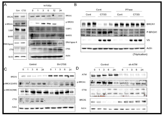 BRCA1 phosphorylation modulates BRCA1 protein expression by CTSS. (A)Western blot analysis demonstrating expression levels of the DNA damage-related proteins in MDA-MB-231 cells transfected with WT-CTSS. MDA-MB-231 cells were irradiated with 10 Gy and after indicated time points, Western blotting was performed on the MDA-MB-231 cells. (B)Western blot analysis in control or WT-CTSS transfected MDA-MB-231 cells treated with Lamda phospate(Ppase). (C,D)Western blot analysis in sh-CTSS or sh-ATM transfected MDA-MB-231 cells treated with 10Gy radiation for various lengths of time