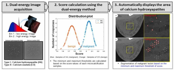 악성과 양성의 미세석회화에서 악성 병변만을 자동 분류하는 Workflow 설계