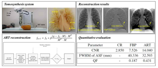 가슴 단층영상합성 시스템에서의 영상획득 후 반복적 재구성 알고리즘 개발 및 검증