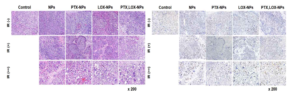 Xenograft 모델에 방사선 조사 및 방사선 유도 나노전달체 후 H&E 염색(좌) 및 PCNA 염색 (우)