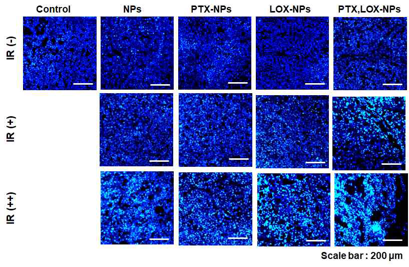 Xenograft 모델에 방사선 조사 및 방사선 유도 나노전달체 후 TUNEL 염색