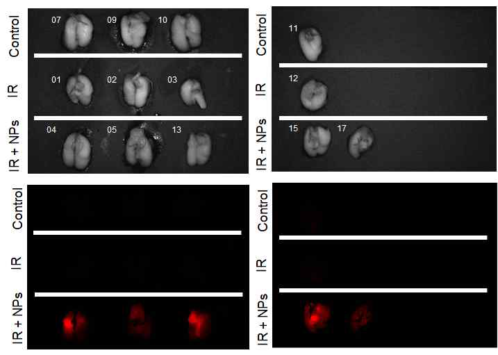 Orthotopic in vivo 모델에서 채취한 폐조직의 ex vivo 영상을 통한 방사선 유도 나노전달체의 전달 확인