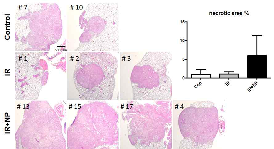 Orthotopic in vivo 모델에서 채취한 폐조직의 H&E 염색