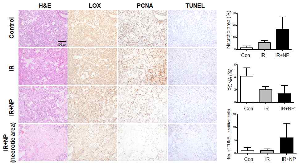 Orthotopic in vivo 모델에서 채취한 폐조직의 조직학적 분석