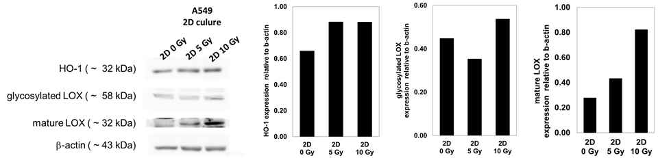A549에서 방사선 조사 후 표적 단백질의 발현 및 정량적 분석