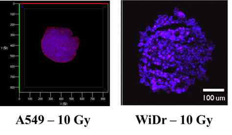 3차원 A549 spheroid model과 3차원 WiDr spheroid model에서 10 Gy 방사선 조사 후 표적 단백질인 세포외 배출 단백질 LOX의 발현 확인