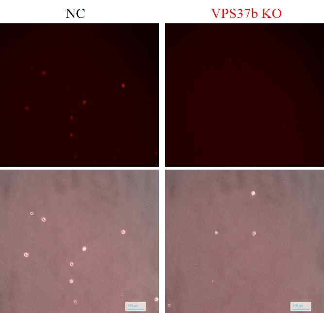 Immunofluorescent staining of VPS37b