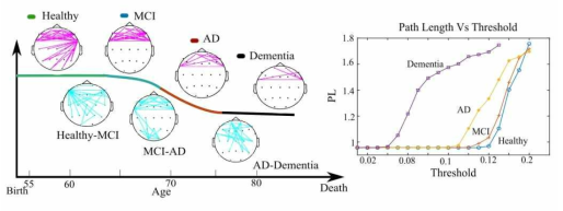 Functional connectivity and path length in Alzheimer’s subjects