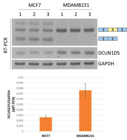 암 전이 특이적 DCUN1D5의 RNA alternative splicing 차이와 AS-NMD에 의한 DCUN1D5의 발현량 변화