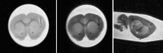 ex vivo MRI를 위한 조건확립. 뇌 섬염 자극이후 뇌 영상 촬영을 위한 조건의 확립
