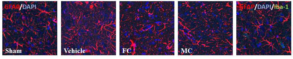 IC에서의 astrocyte와 microglia의 형태변화 관찰. 각 그룹의 조건에 따라 다르게 분화한 astrocyte와 microglia의 모양을 확인할 수 있으며, 그 차이가 통증의 발달과 깊은 상관관계를 가짐을 보여주었다