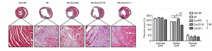 심근경색 모델에서 성분 강화 엑소좀을 투여 한 후 섬유화 소견의 비교