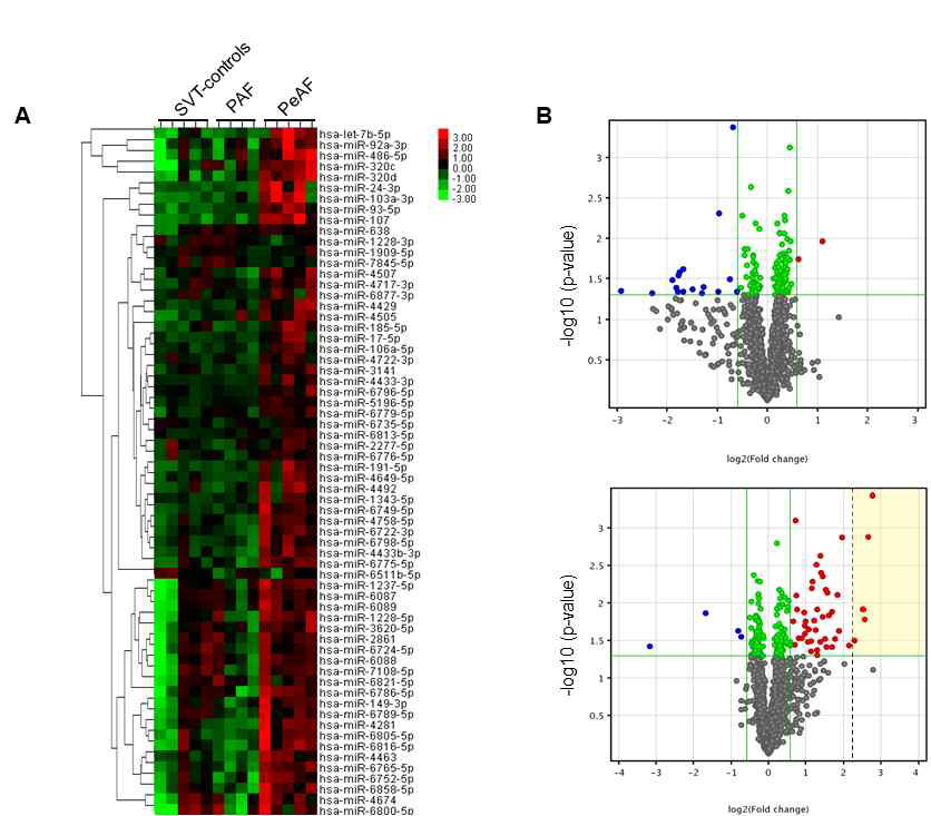 miRNAs. microarray 분석. (A) Heatmap. upregulation (red) and downregulation (green). (B) Volcano plots of the miRNA profiles of PAF (upper panel) and PeAF (lower panel) as compared with those of non-AF