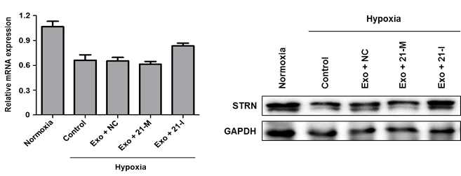 허혈에 노출된 H9C2 세포 모델에서 엑소좀을 투여한 후 STRN의 변화 비교