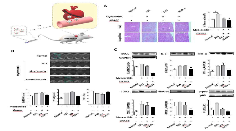 RAGE siRNA를 로딩 개발된 심장전달 미세소포체의 심근염 쥐에서 효과. A, 심근염 억제되는 조직학 소견.B, B, 심장기능이 호전되는 심초음파 소견, C. 다양한 염증인자 억제 소견