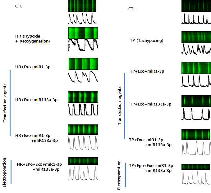 좌측. 허혈 손상 모델에서 칼슘 분비 후 흡수 장래로 칼슘 증가 소견 보임. miR 1, 133 투여는 억제 효과 보임. 우측. 빈맥 조율 모델에서 칼슘 분비 증가 빈도수 증가 소견 보임. miR 1, 133 억제 효과 보임