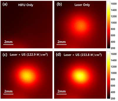 생체조직모사팬텀에 2 mm 직경의 원을 만들어 형광물질을 주입해 형광영상을 획득하여 개발한 이중모드 프로브에 의한 광 투과깊이 증가 성능 검증: (a) HIFU만 조사한 경우 (b) 레이저만 인가한 경우 (c)-(d) 레이저와 초음파(122.9W/cm2 와 153.8W/cm2) 를 동시에 조사한 경우