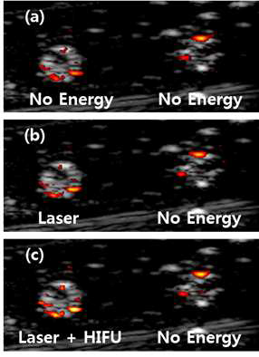 형광 물질에서 발생되는 광음향 신호를 이용해 형성한 광음향 영상(왼쪽: 실험군, 오른쪽: 대조군): (a) 치료용 레이저와 초음파를 전혀 인가하지 않은 경우, (b) 치료용 레이저만 인가한 경우, (c) 레이저와 초음파 에너지를 함께 인가한 경우