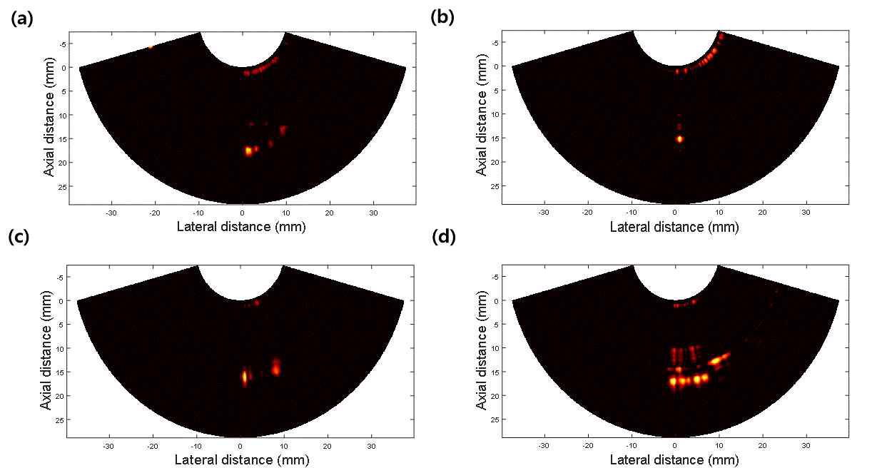 회전모듈과 이중모드 프로브를 통해 얻은 광음향 영상: (a) 치료용 레이저와 초음파를 전혀 인가하지 않은 경우, (b) 치료용 레이저만 인가한 경우, (c) 치료용 레이저와 초음파를 전혀 인가하지 않은 경우, (d) 레이저와 초음파 에너지를 함께 인가한 경우