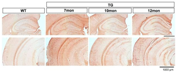 P301L tau mutant mouse의 노화에 따른 해마와 내후각 피질에서의 타우과인산화 양상