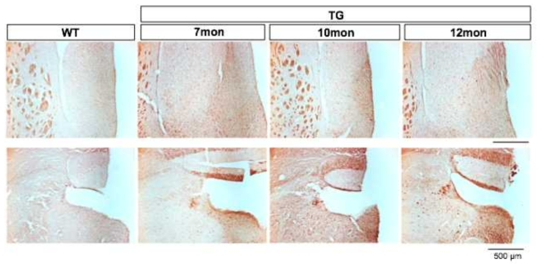 P301L tau mutant mouse의 노화에 따른 basal forebrain과 청색반점에서의 타우과인산화 양상