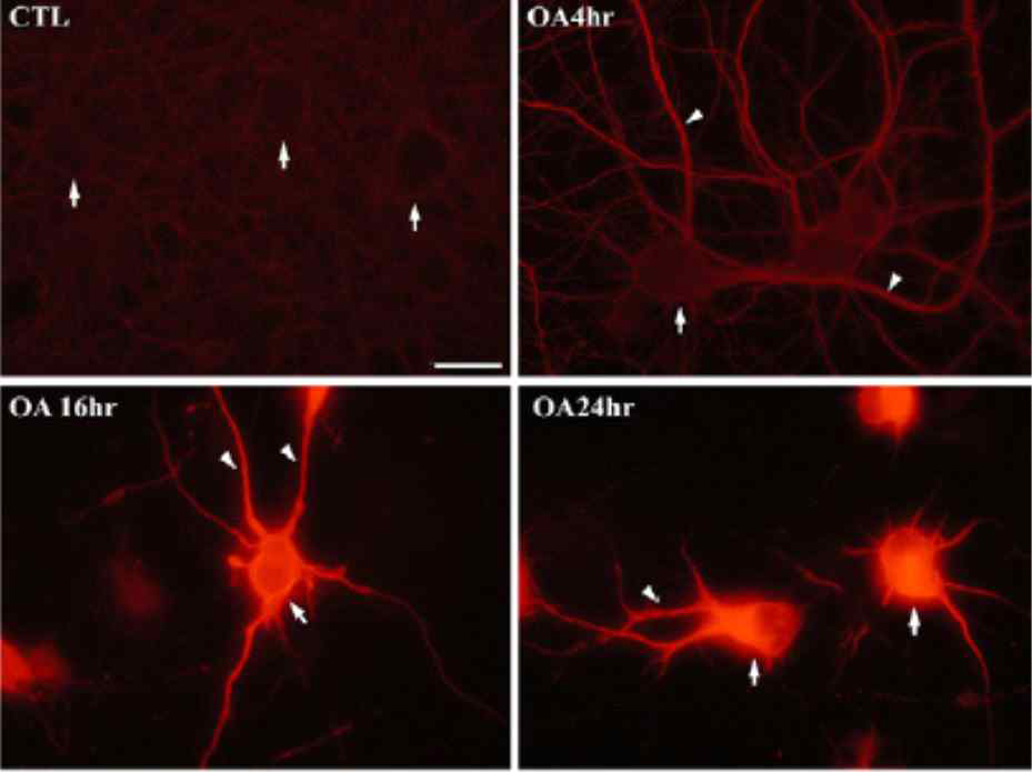 신경세포 배양에 타우 과인 산화를 유도하는 okadaic acid 처리 후 면역염색을 통해 관찰한 Ac-tubulin 발현 양상