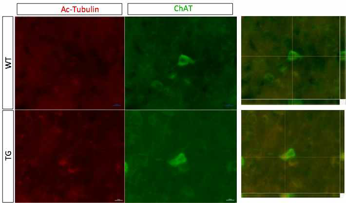 콜린성 뉴런에 대한 표지 단백질 (ChAT)과 Ac-tubulin 단밸질에 대한 이중면역염색 결과