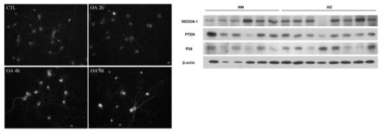 신경세포 배양 okadaic acid 처리 후 시간에 따른 PTEN의 발현 양상 (왼쪽)과 AD brain에서의 p34 및 PTEN poly-ubiquitination 양상 (오른쪽)