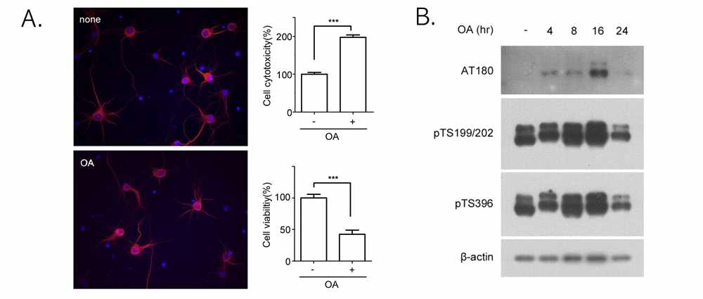 Okadaic acid (OA) 처치 후 세포사멸 및 타우과발현 양상. A) 세포배양 10일 차에 10 nM의 okadaic acid를 처치한 후 LDH assay와 MTT assay를 통해 살펴 본 cell cytotoxicity와 viability 결과. B) 세포배양 후 okadaic acid 를 처치하고 시간 경과에 따른 타우과인산화 양상. ***p < 0.001 by one-way ANOVA, the Tukey post-hoc test